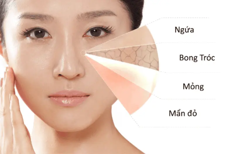 Bí Quyết Chọn Kem Dưỡng Ẩm Cho Da Nhạy Cảm Lành Tính, Hiệu Quả Nhất